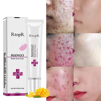RtopR Mango Repair Tretman Za Akne Krema Za Lice Popravak Liječenje Sužavanje Pora Hidratantna Krema Za Ožiljke Njegu Kože Lica Kozmetika Izbjeljivanje